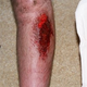 Illustration for article titled Blood Writes: Man Slides Into Third And Winds Up Wearing A Maxi Pad
